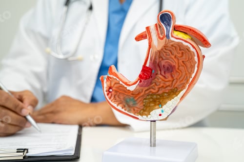 Preview: Stomach disease, doctor with human anatomy model for study diagnosis and treatment in hospital.
