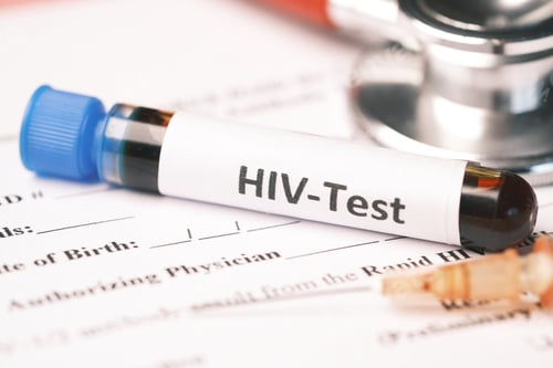 Preview: HIV blood test tube and prescription on table