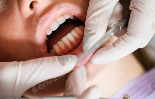 Preview: Dental Check