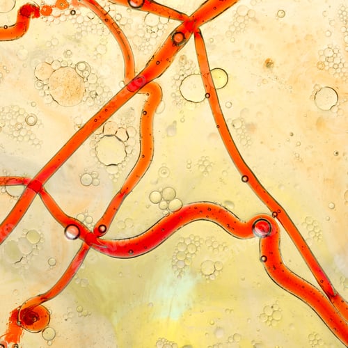Preview: abstract blood vessels