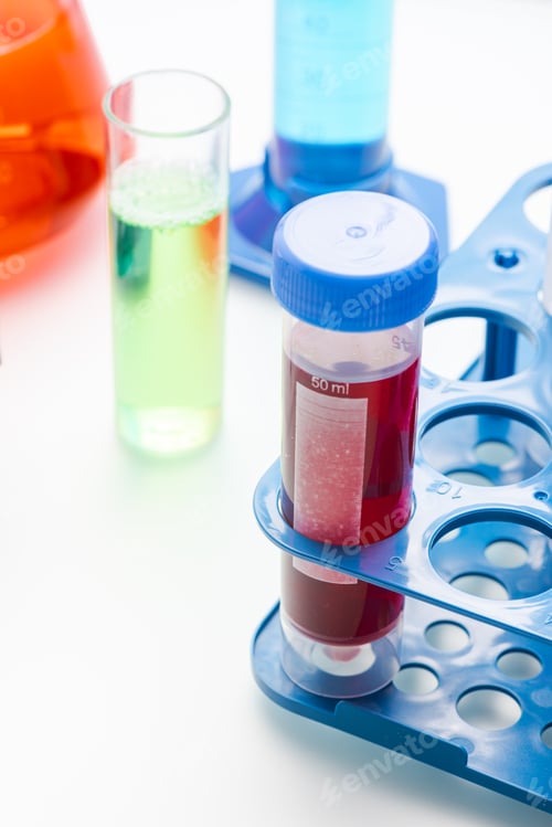 Preview: Blood Testing Samples in Laboratory. Covid-19 Blood Test Concept