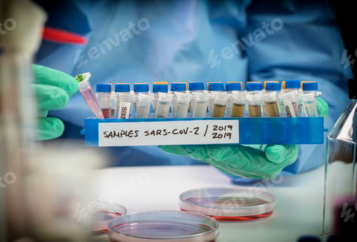 Preview: Vials with samples of SARS-COV-1 prepared cold in a laboratory,