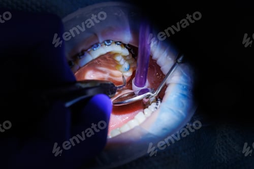 Preview: The dentist treats the patient's teeth with dental equipment and holds dental instruments