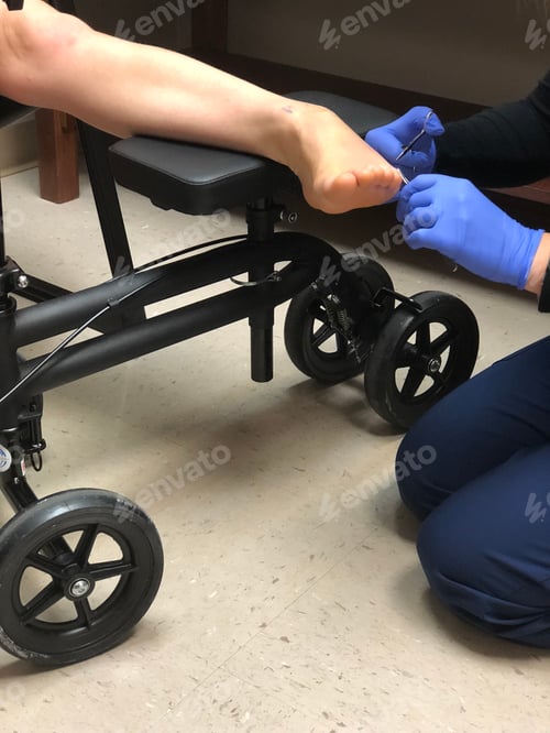 Preview: Woman getting stitches taken out of foot after surgery
