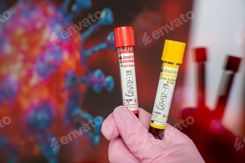 Preview: Closeup shot of COVID-19 tests partially full of blood