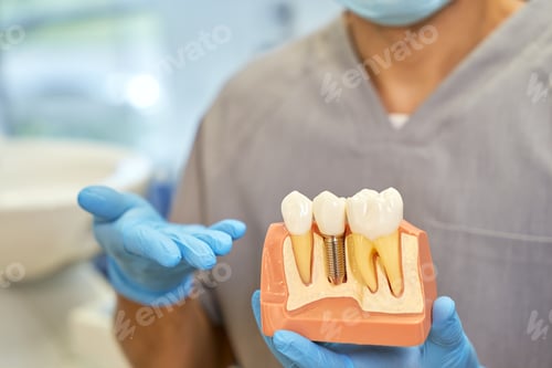 Preview: Skilled dental technician posing with a model of dental implant