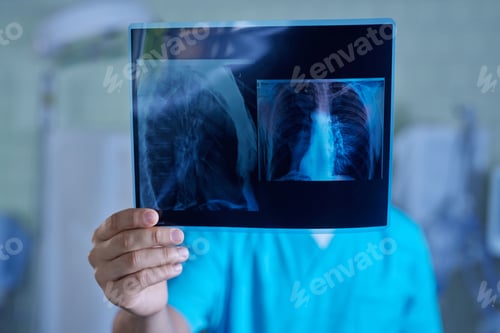 Preview: doctor holding x-ray result close up, ultrasonic ultrasound machine, selective focus