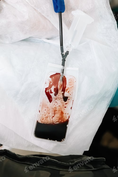 Preview: Blood bag in medical laboratory. International Blood Donation Day.