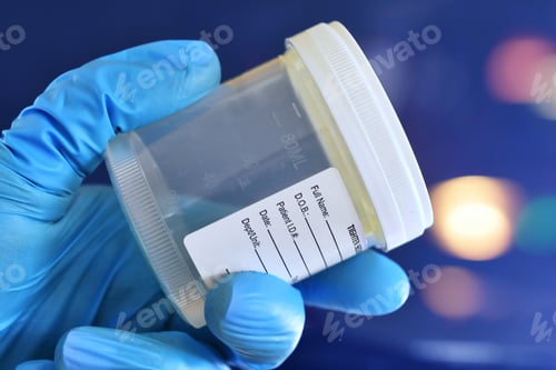 Preview: Medical personnel doctor nurse holding urine or semen specimen cup for sample to be tested.