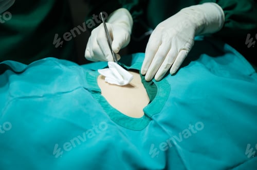 Preview: professional surgeon doctor team are working for surgery in medical operating room at hospital