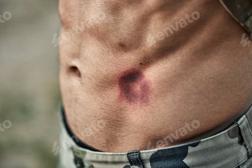 Preview: Paintball injury, stomach bruise and man in closeup with pain, shooting or accident for outdoor war