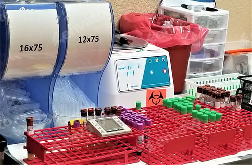Preview: Vials! Laboratory Supplies! Phlebotomy Equipment for Testing Blood Samples!