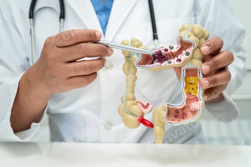 Preview: Intestine, appendix and digestive system, doctor holding anatomy model