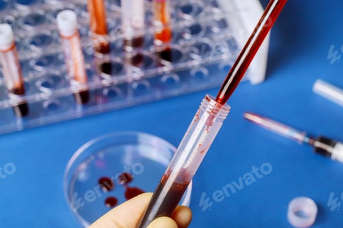 Preview: Pipette adding fluid of biochemistry blood tests medical testing on microbiology lab