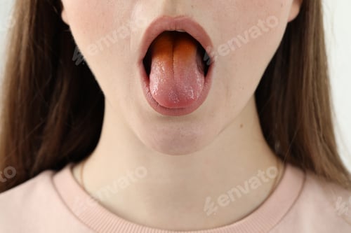 Preview: Gastrointestinal diseases. Woman showing her yellow tongue, closeup