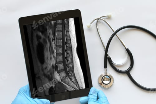 Preview: Doctor, medical professional technician using a computer tablet to view read MRI results