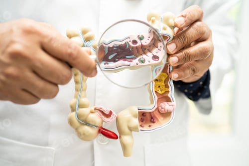 Preview: Intestine, appendix and digestive system, doctor holding anatomy model for study diagnosis