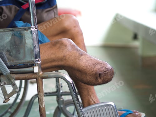 Preview: stump training for prosthesis device