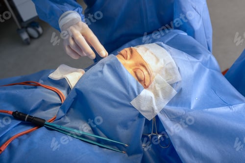 Preview: Eyelid Blepharoplasty Cosmetic Surgery Procedure in Clinic by Professional Medical Staff