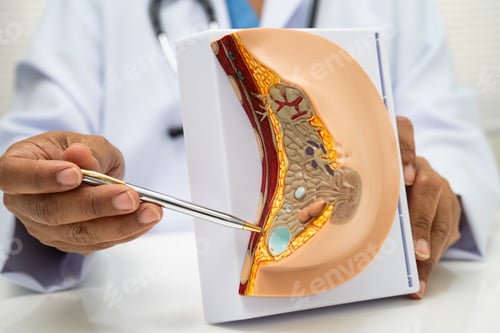 Preview: doctor holding female breast human anatomy model.
