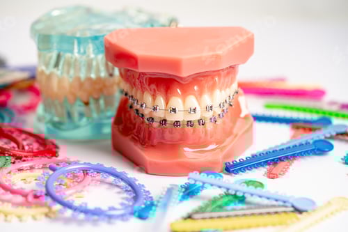 Брекеты Стоковые фотографии, картинки, все без лицензионных отчислений - Envato