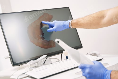 Preview: Male dentist hand pointing at computer display with dental 3D scan