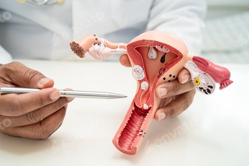 Preview: Uterus, doctor with anatomy model for study diagnosis and treatment in hospital.