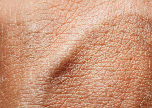 Preview: Close up of Human Skin