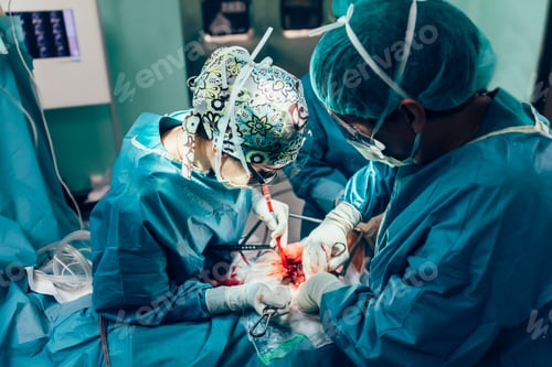 Preview: Team of Surgeons Operating.