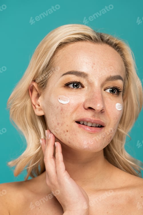 Preview: blonde woman with skin issues applying treatment cream on face isolated on turquoise