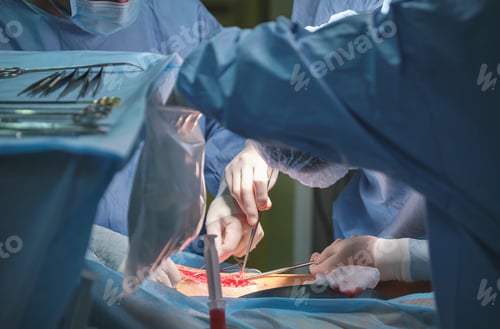 Preview: Surgeons Perform an Operation in Hospital Operating Room
