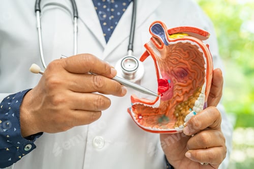 Preview: Stomach disease, doctor holding anatomy model for study diagnosis and treatment in hospital.