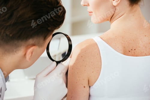 Preview: cropped view of dermatologist holding magnifying glass while examining patient with skin disease