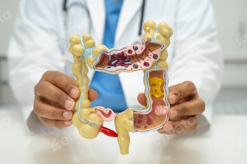 Preview: Intestine, appendix and digestive system, doctor holding anatomy model for study diagnosis
