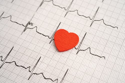 Preview: Red heart on electrocardiogram ECG with red heart, heart wave, heart attack, cardiogram report.
