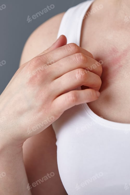 Preview: Cropped close up shot of young woman scratching her chest with fingers
