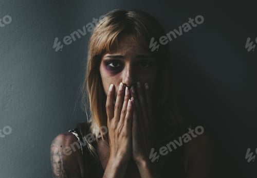 Preview: Beaten woman standing in front of a dark wall demonstrating violence on women.