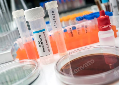 Preview: Vials with samples of SARS-COV-2 Covid-19 in a research laboratory, conceptual image