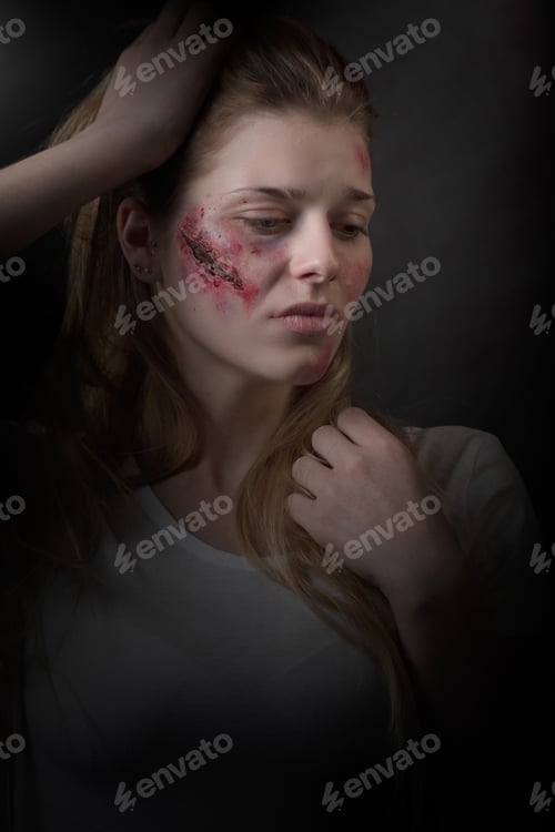 Preview: Portrait of a sad girl who has suffered physical violence.