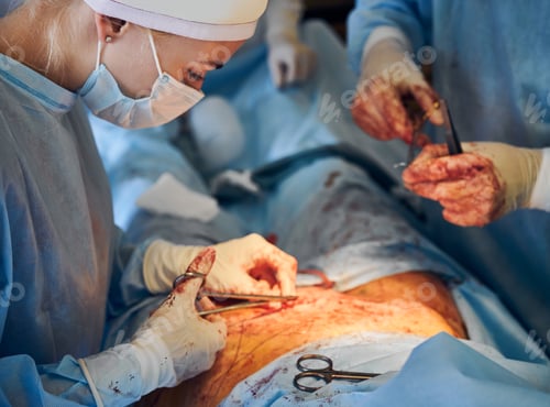 Preview: Surgeons Working on Patient in Operating Room