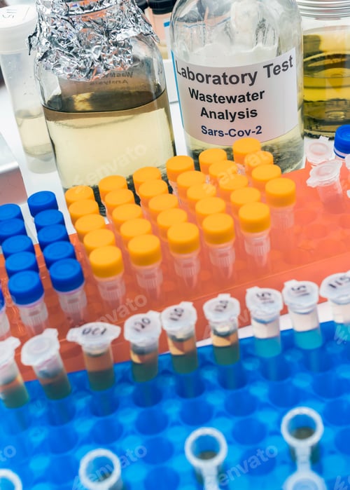 Preview: Wastewater samples, analysis of sars-cov-2 virus in patients infected by human coronavirus 229E