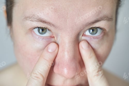 Preview: Close-up of caucasian female adult examining under-eye area with focused expression and rosy