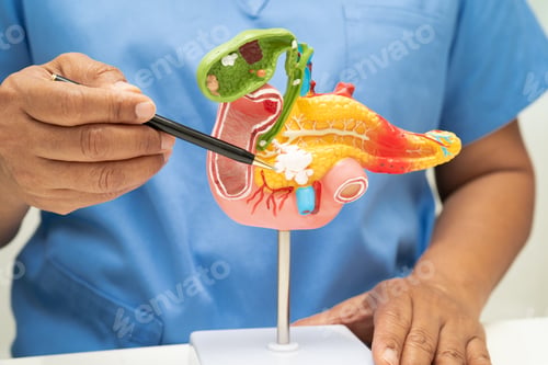 Preview: Pancreatitis, pancreatic cancer, Asian doctor with pancreas, gallbladder and bile duct human