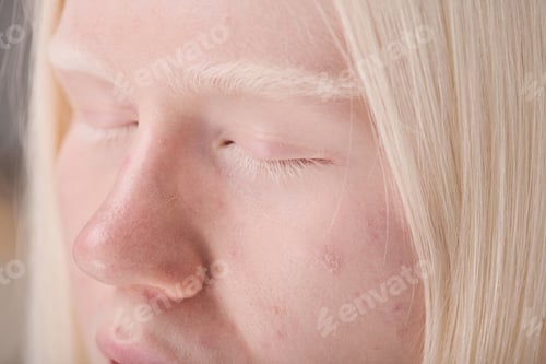 Preview: Young girl with unusual appearance