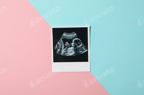 Preview: Concept of maternity, parenting and pregnancy, top view