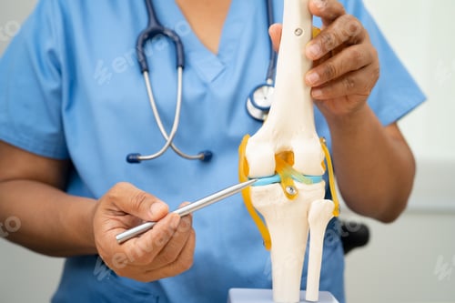 Preview: Osteoarthritis of the knee, Doctor holding human knee joint orthopedic