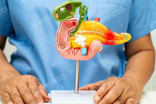 Preview: Pancreatitis, pancreatic cancer, Asian doctor with pancreas, gallbladder