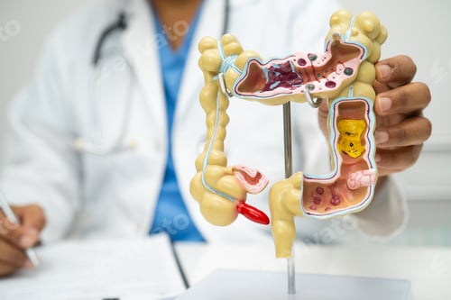 Preview: Intestine, appendix and digestive system, doctor holding anatomy