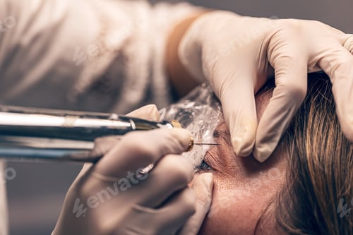 Preview: Plasma eye lift