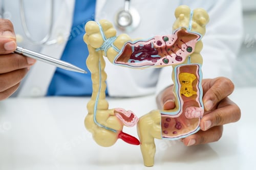 Preview: Intestine, appendix and digestive system, doctor holding anatomy model